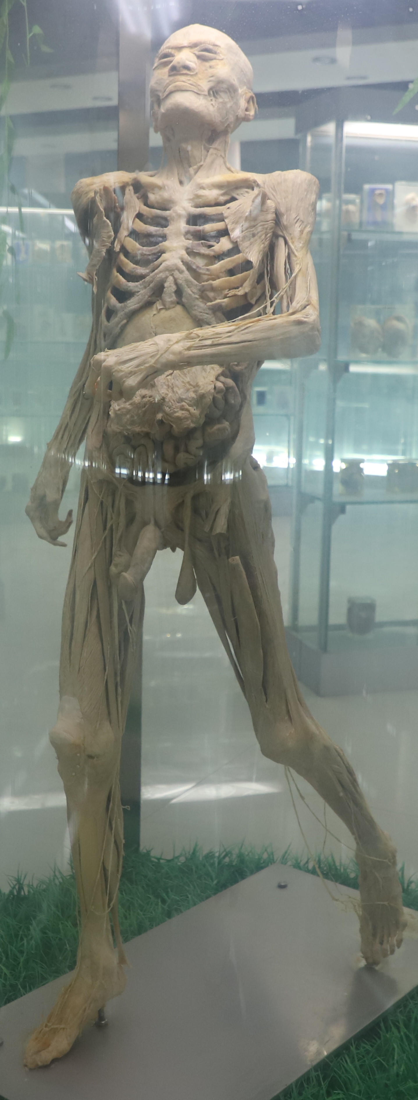 生命科学人体标本,人体标本是活人还是死人