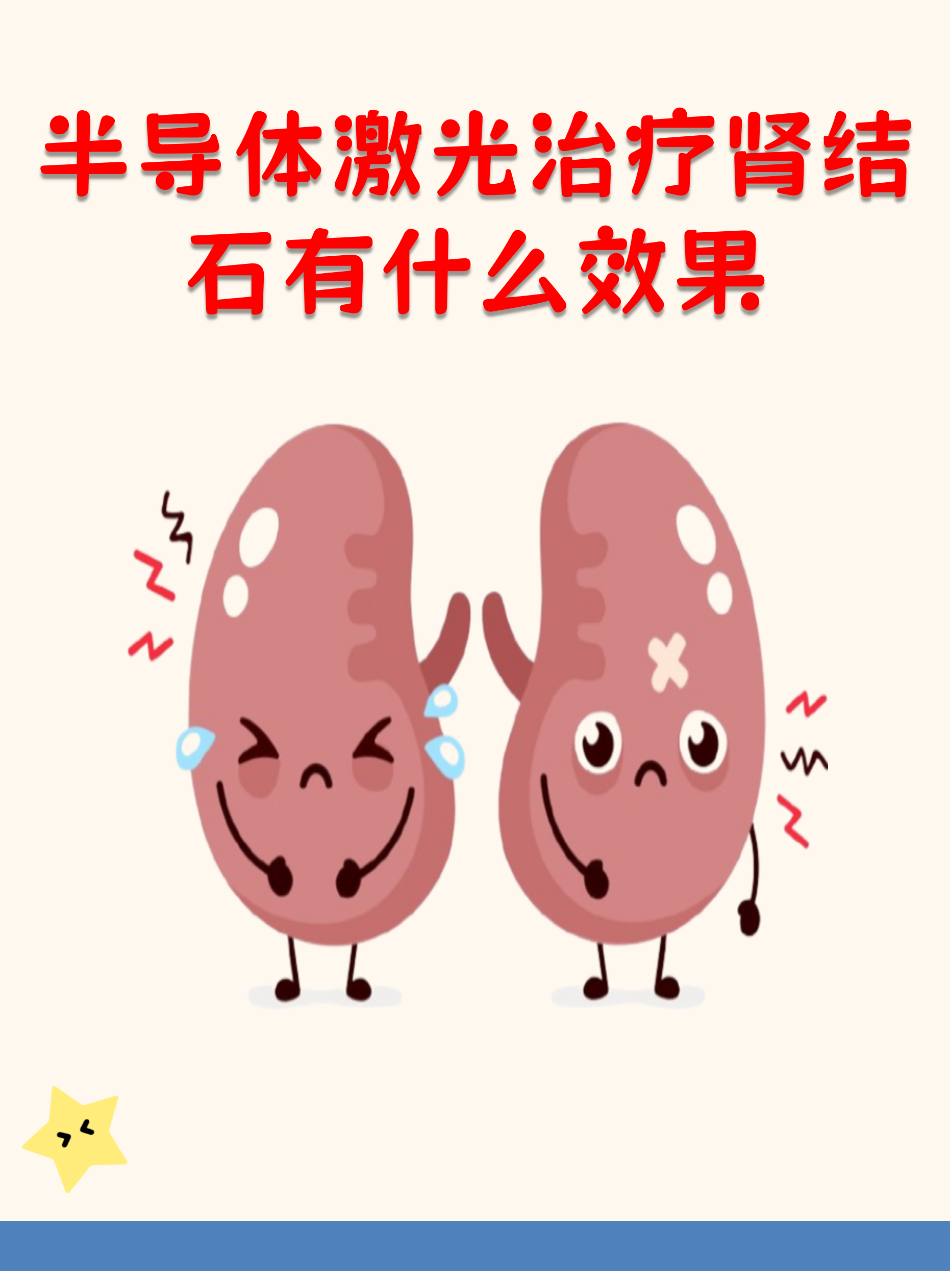 治疗肾结石的科技前沿,目前国内治疗肾结石最顶尖的医疗技术是什么 治疗肾结石的科技前沿,目前国内治疗肾结石最顶尖的医疗技术是什么