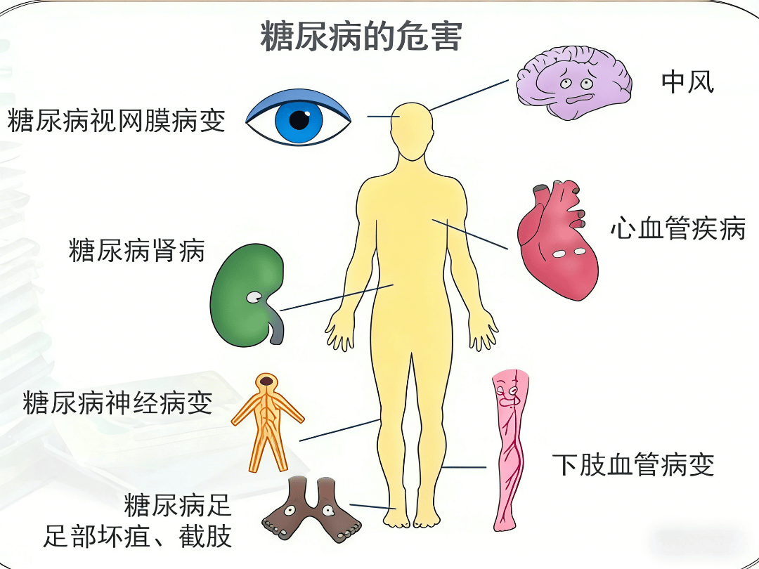糖尿病治疗科技前沿,当前治疗糖尿病最前沿的技术 糖尿病治疗科技前沿,当前治疗糖尿病最前沿的技术