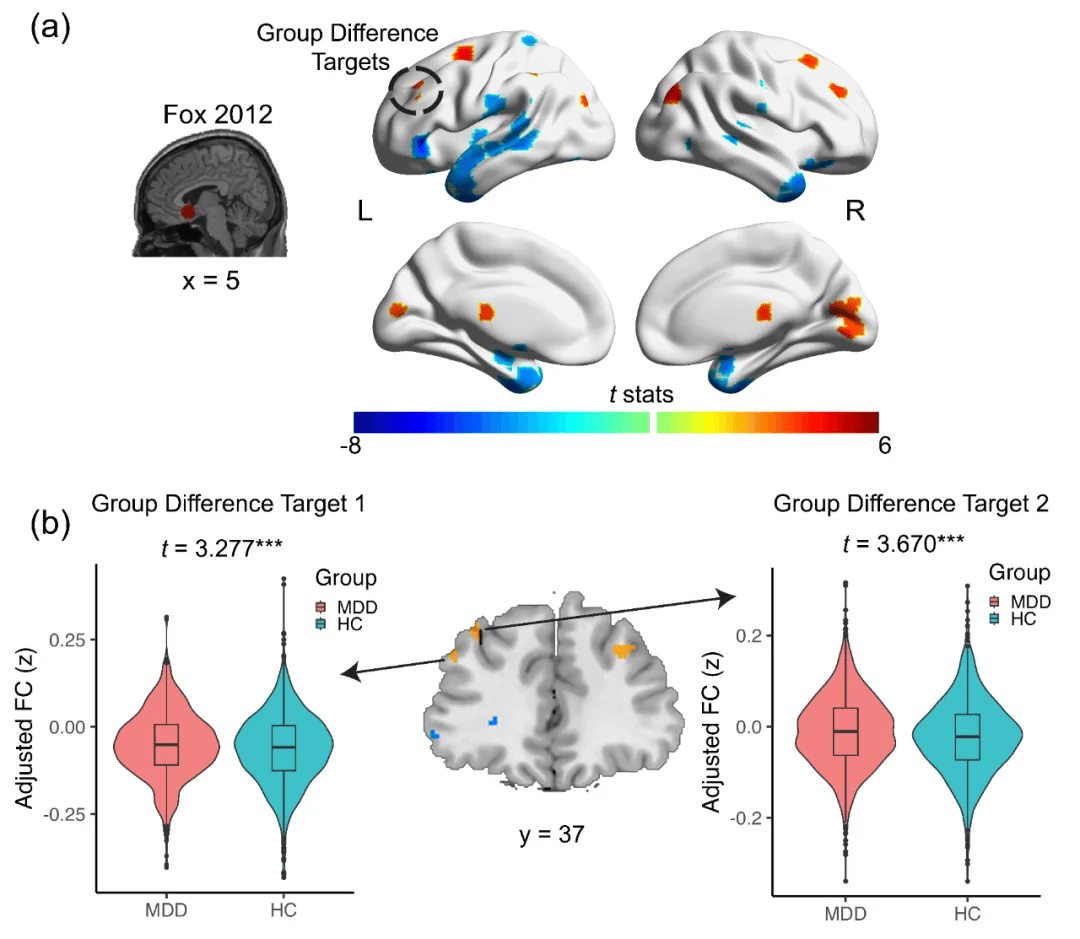 生命科学研究所抑郁症,生命科学研究院院长是谁 生命科学研究所抑郁症,生命科学研究院院长是谁