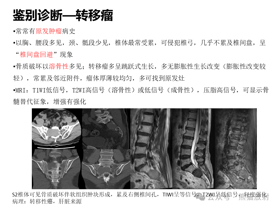脊索瘤的科技前沿研究,脊索瘤的科技前沿研究是什么