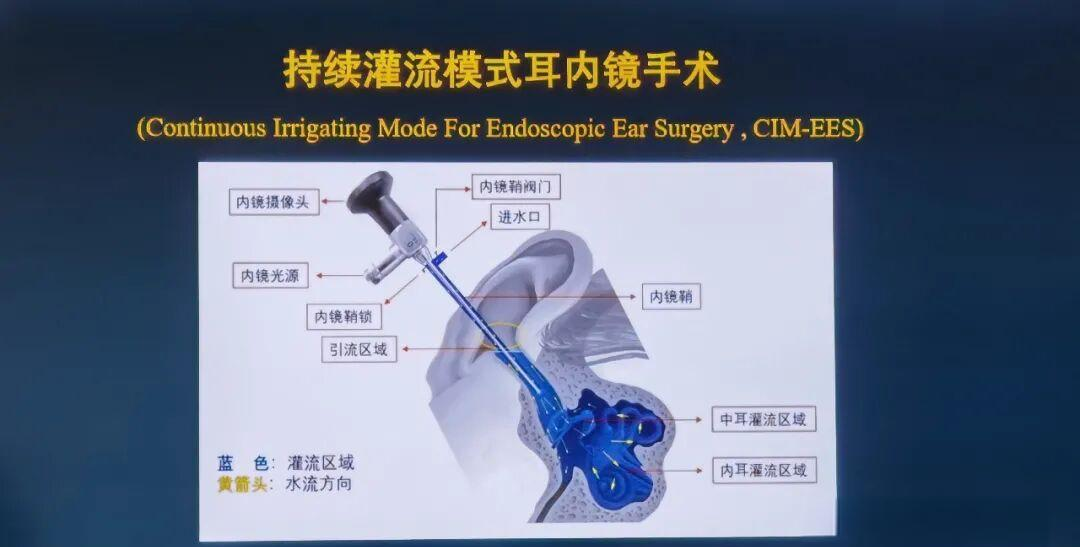 医学科技前沿听力,听力及言语康复专业 医学科技前沿听力,听力及言语康复专业