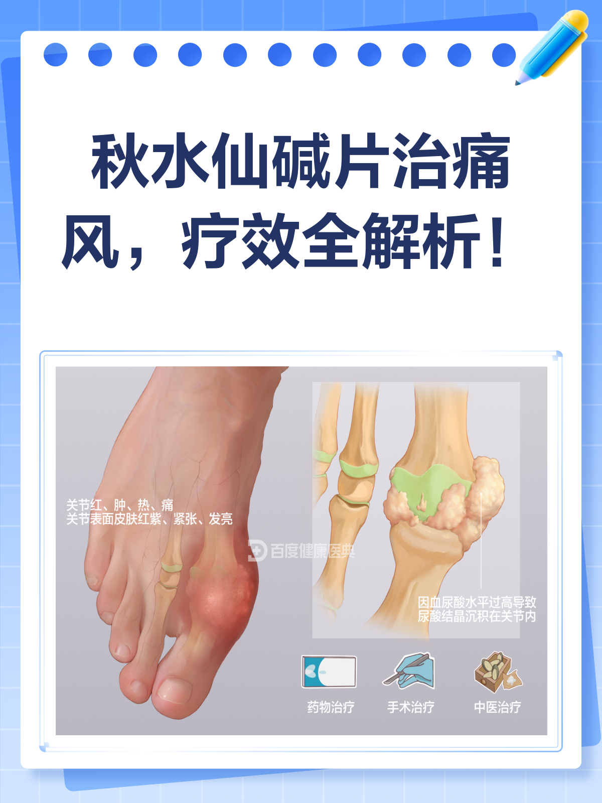 吉林生命科学院痛风药,吉林治疗痛风最权威医院 吉林生命科学院痛风药,吉林治疗痛风最权威医院