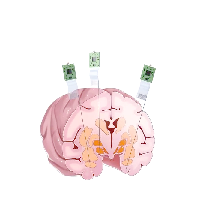 脑神经科技前沿研究,脑神经科技前沿研究方向