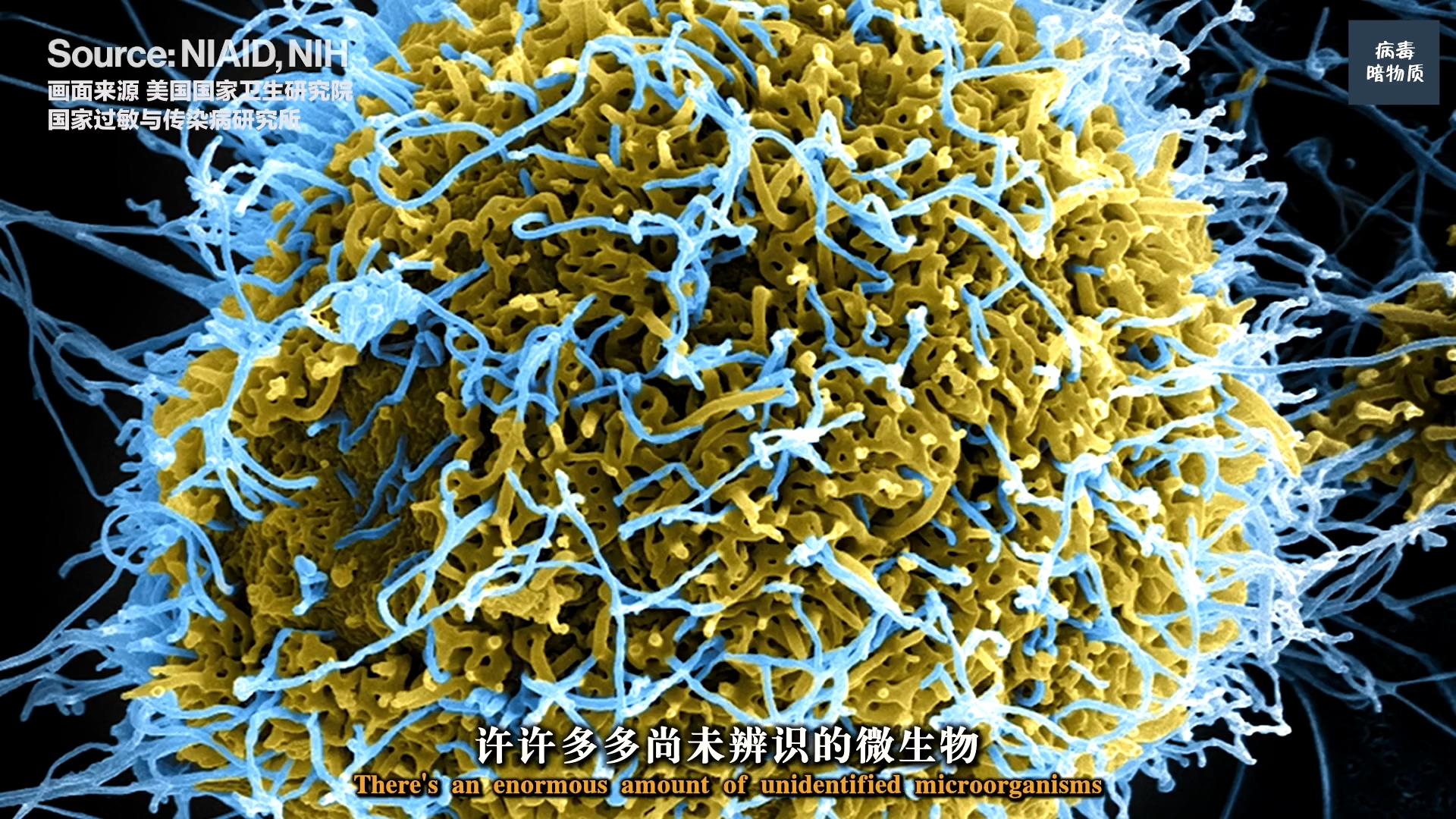 生命科学探索二十四集,生命科学探索二十四集在线观看 生命科学探索二十四集,生命科学探索二十四集在线观看
