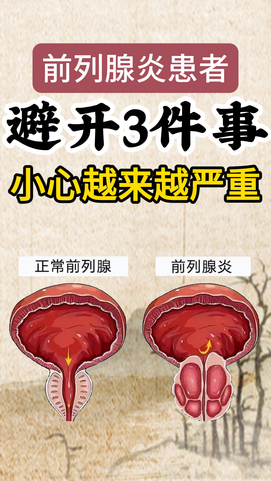 科技前沿前列腺炎,前列腺炎最新研究突破