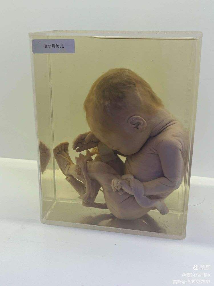 湛江卫校生命科学馆,广东湛江卫生学校,血液透析,出来好找 湛江卫校生命科学馆,广东湛江卫生学校,血液透析,出来好找