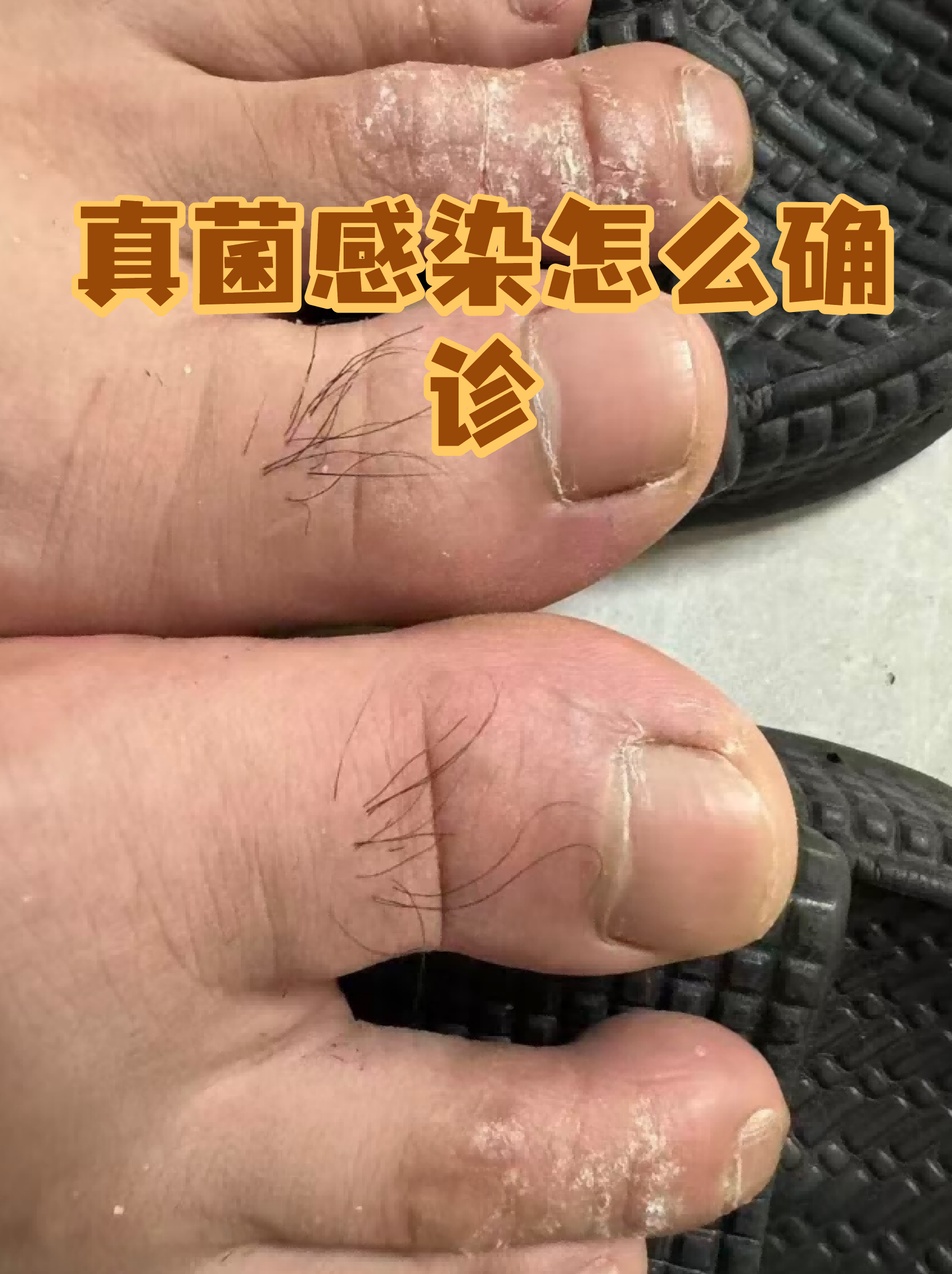 疫情跟世界末日一样