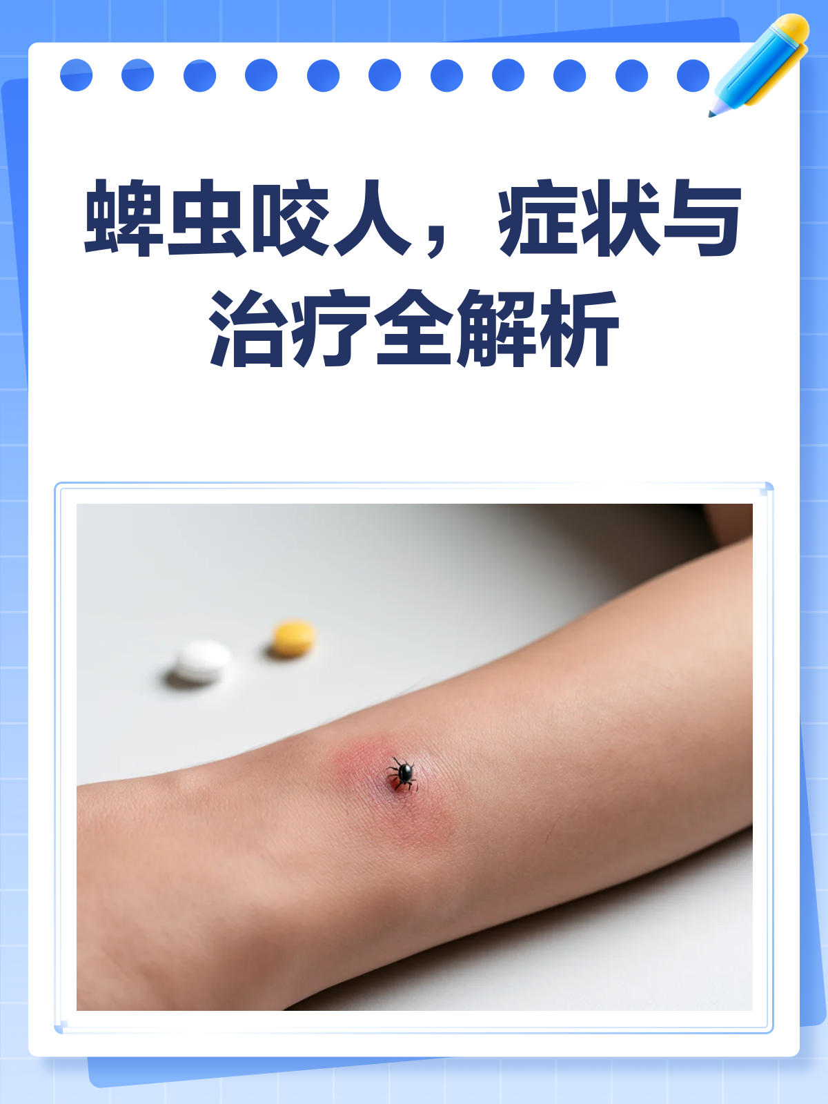 蜱虫咬伤会死人吗