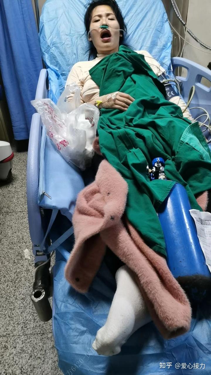 关于在哪女子被蜱虫咬伤住ICU28天四肢瘫痪的信息